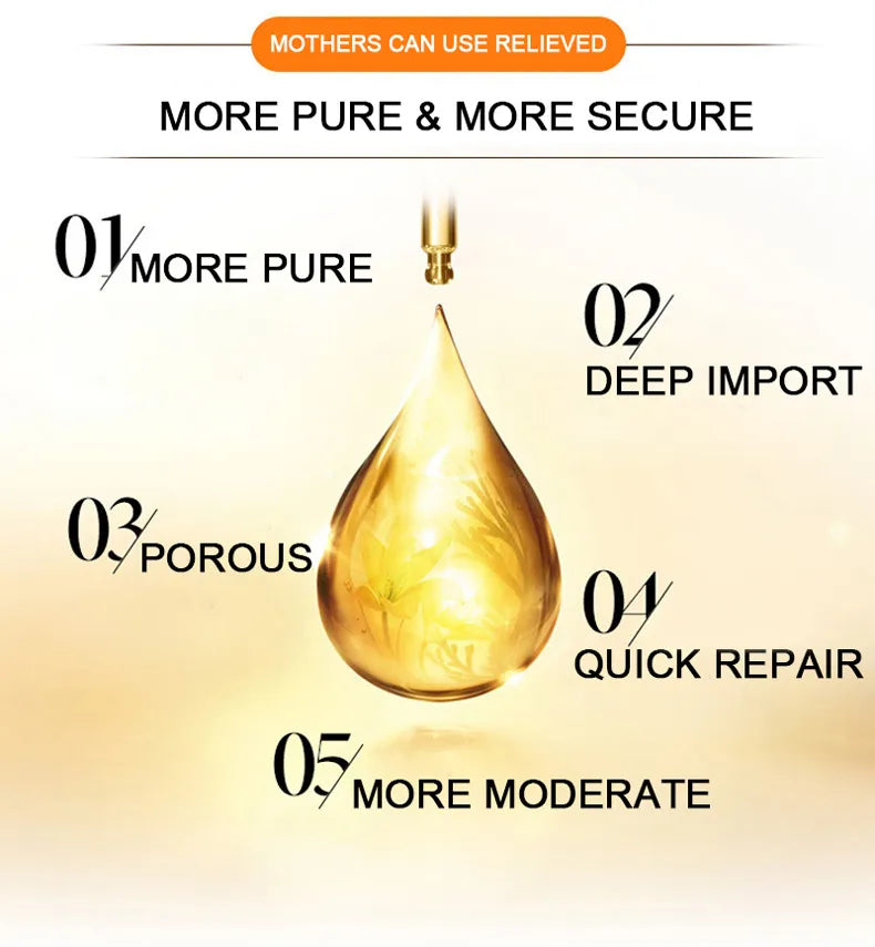 Removes Stretch Marks Oil (Buy 2 Get 10% OFF)