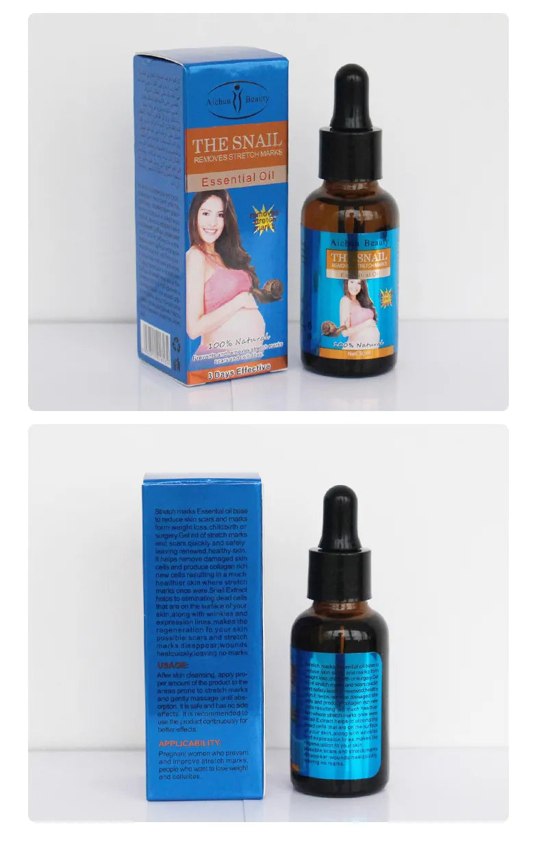 Removes Stretch Marks Oil (Buy 2 Get 10% OFF)