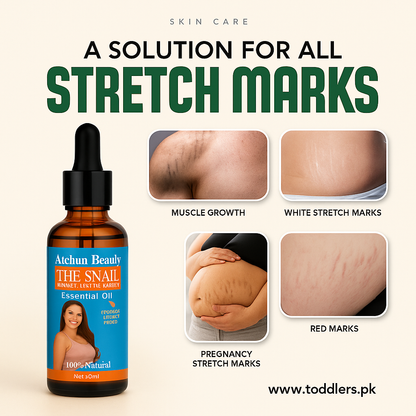 Stretch Marks Removal Maternity Skin Body Repair Serum